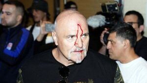 Tyson Fury’s father John suffers cut to head as Oleksandr Usyk fight week begins Tyson Fury’s father John suffers cut to head as Oleksandr Usyk fight week begins