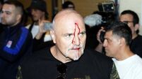 Tyson Fury’s father John suffers cut to head as Oleksandr Usyk fight week begins