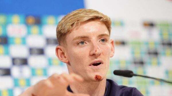 Anthony Gordon takes team-mates’ jokes on the chin after bike accident
