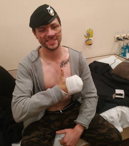 Robert Deegan recuperating from his injuries last year