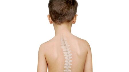 Laois disabled activist tackles Taoiseach Simon Harris over children waiting for spinal surgery