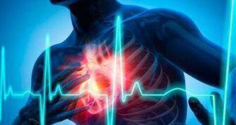Laois TDs sign up to heart and stroke campaign