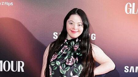 Model Ellie Goldstein announced as latest celebrity for Strictly Come Dancing