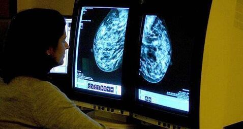 HSE says ‘problem’ with viewing BreastCheck register will be fixed next week
