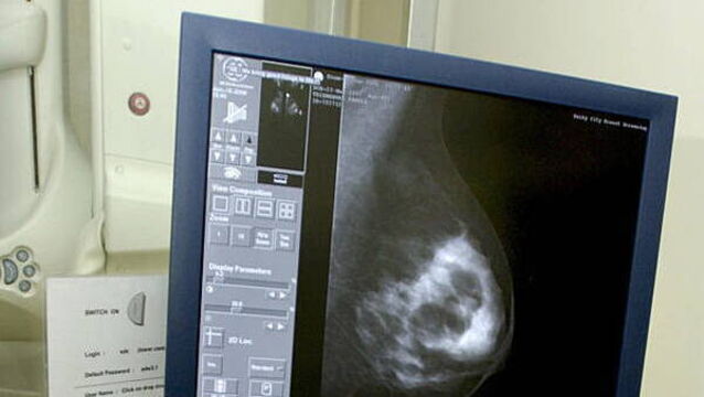 Tipperary nurse sues over alleged delay in breast cancer diagnosis