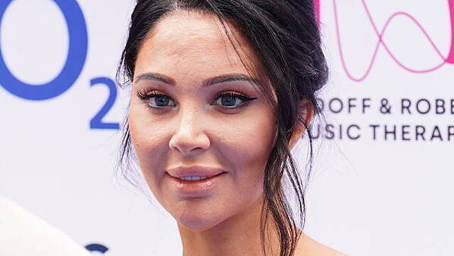 Tulisa reveals ‘minor’ but short-term paralysis after Bell’s palsy attack
