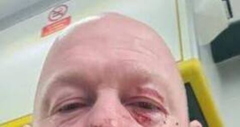 Carlow father headbutted coach after son was substituted in under-12 match 