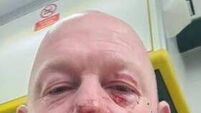 Carlow father headbutted coach after son was substituted in under-12 match 