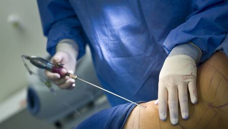 Judge revokes Laois woman’s legal aid after learning she had paid for cosmetic surgery including 'a butt lift.'